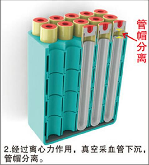 脱帽离心机的脱帽原理