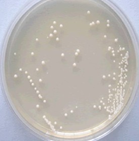 实验室常用微生物菌种的分离和纯化方法