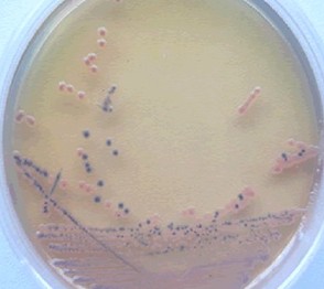 实验室常用微生物菌种的分离和纯化方法